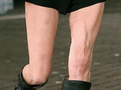 Przerażająca Kate Moss